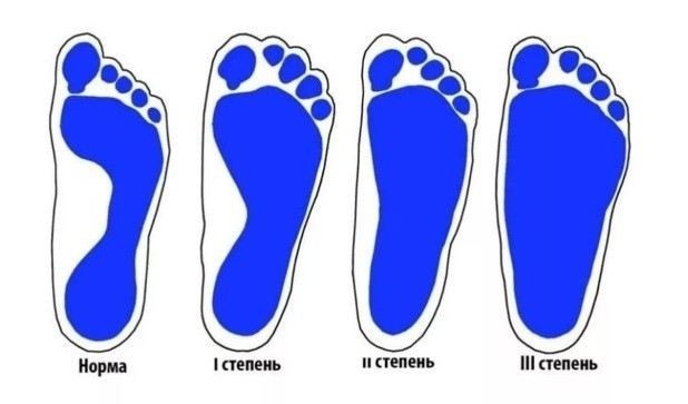 Какие медицинские документы могут помочь при освобождении от службы?