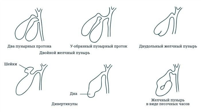 Что нужно знать о деформации желчного пузыря при прохождении медосвидетельствования