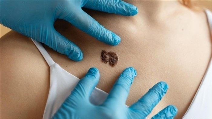 Горячая линия прокуратуры по жалобам на оказание соцуслуг: как обратиться