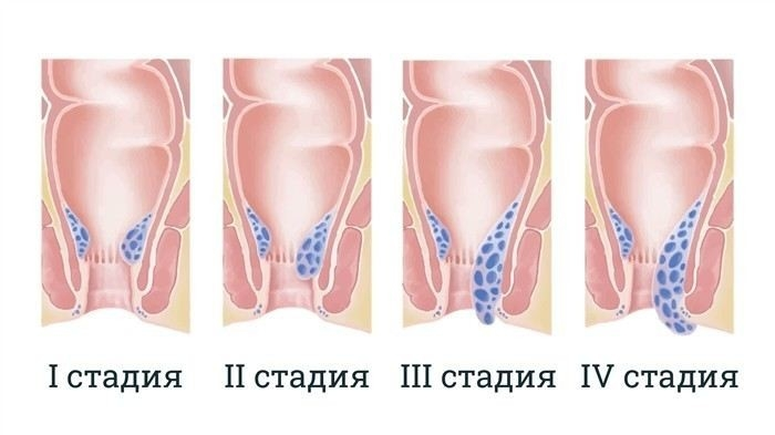 Как армейская служба усугубляет симптомы заболевания