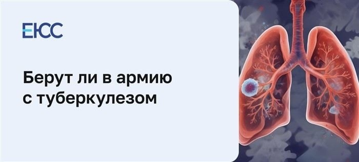 Можно ли служить в армии с туберкулёзом?