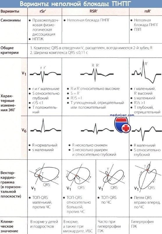 Анатомия электрической проводимости сердца и её связь с блокадой правой ножки пучка Гиса