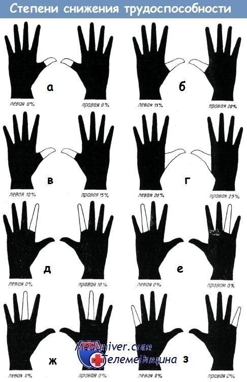 Особенности установления инвалидности для детей с генетическими заболеваниями