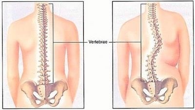 Как распознать транзиторную АВ-блокаду 2 степени в условиях неотложной помощи