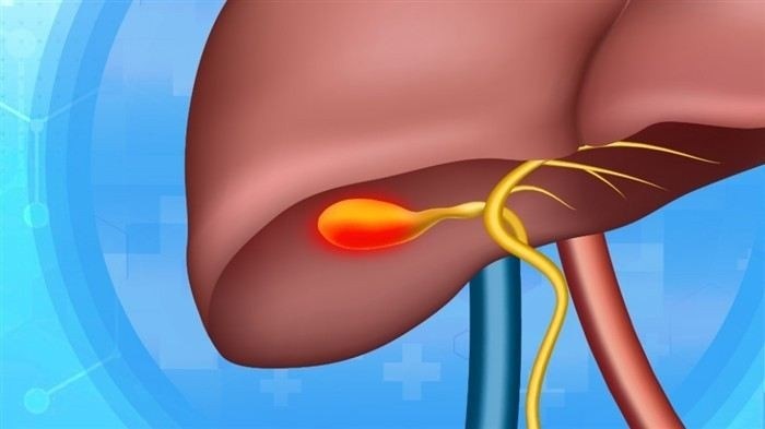 Причины диареи после удаления желчного пузыря